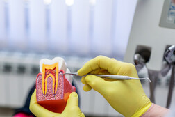  Dentista che spiega l'aspetto della cavità dentale. Paradontite denti Foto: bluecinema - iStock