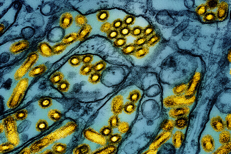 In giallo le particelle del virus dell'influenza aviaria A H5N1 viste al microscopio (fonte: CDC e NIAID, via Flickr)