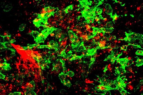 In rosso la fibrina e in verde la microglia nel cervello di un topo infettato da Covid-19 (fonte: Jae Kyu Ryu e Katerina Akassoglou, Gladstone Institutes)