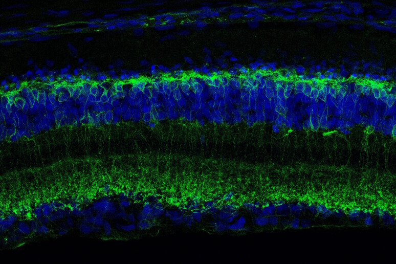 Sezione trasversale di una retina degenerata vista al microscopio confocale. In verde le cellule attivate dalla molecola Ziapin2 (fonte:  Istituto Italiano di Tecnologia - IIT) - RIPRODUZIONE RISERVATA